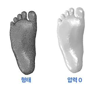 체중 부하 0% 상태의 발