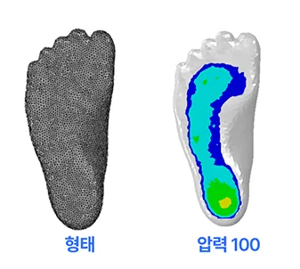 체중 부하 100% 상태의 발