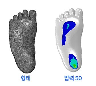 체중 부하 50% 상태의 발